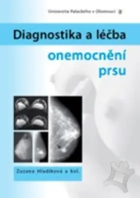 Diagnostika a léčba bipolární poruchy